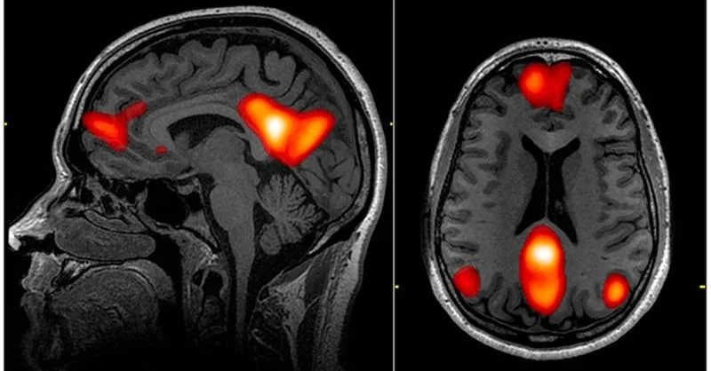 La red por defecto y su influencia en la experiencia consciente humana